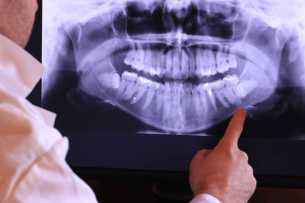 Best Emergency Root Canal Therapy in Maysville, OK
